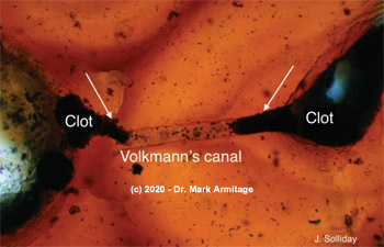 dinosaur blood clots